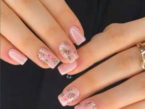 کاشت و ترمیم  تخصصی ناخن در اراک